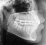 Radiologia Odontológica em Lages